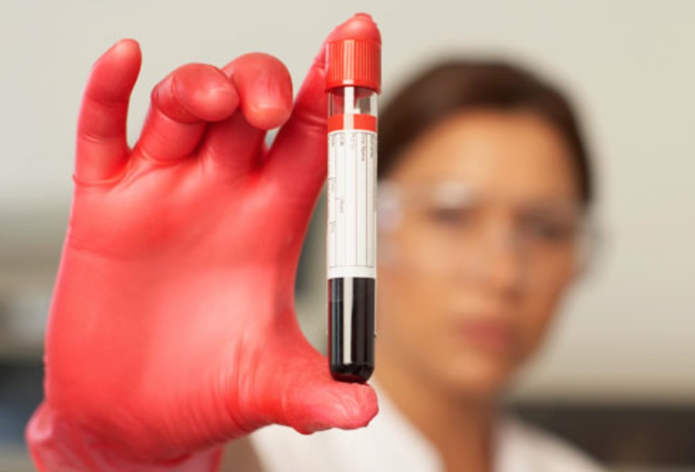 anti-aging blood test